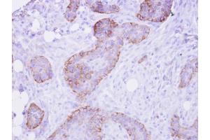 IHC-P Image FRS2 antibody detects FRS2 protein at membrane on HSC-3 xenograft by immunohistochemical analysis. (FRS2 抗体  (Center))