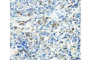 Immunohistochemistry (Paraffin-embedded Sections) (IHC (p)) image for anti-Solute Carrier Family 25 (Mitochondrial Carrier, Oxoglutarate Carrier), Member 11 (SLC25A11) antibody (ABIN7264223)