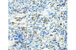 Immunohistochemistry of paraffin-embedded Rat spleen using SLC25A11 Polyclonal Antibody at dilution of 1:100 (40x lens). (SLC25A11 抗体)