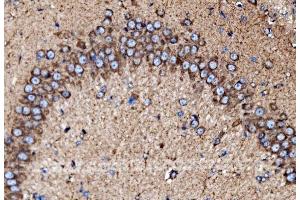 IHC analysis of MDH2 using anti-MDH2 antibody (ABIN7602618).