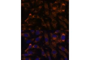 Immunofluorescence analysis of U-2 OS cells using SUCLG2 Polyclonal Antibody  at dilution of 1:100 (40x lens). (SUCLG2 抗体  (AA 50-300))