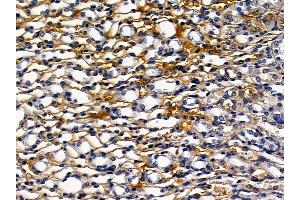 anti-K-Cadherin (CDH6) (C-Term) antibody