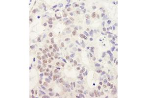 Immunohistochemistry (IHC) image for anti-DEAH (Asp-Glu-Ala-His) Box Polypeptide 38 (DHX38) (C-Term) antibody (ABIN7453692)