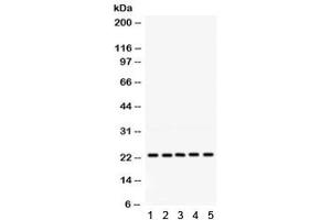 Western blot testing of 1) rat testis, 2) rat lung, 3) human 293, 4) human HeLa and 5) human HepG2 lysate with RAB18 antibody. (RAB18 抗体)