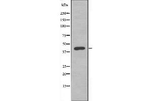 Western blot analysis of extracts from HeLa cells, using DUSP9 antibody. (DUSP9 抗体  (Internal Region))