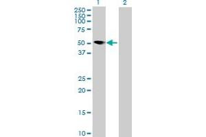 Western Blot analysis of MNDA expression in transfected 293T cell line by MNDA MaxPab polyclonal antibody. (MNDA 抗体  (AA 1-407))