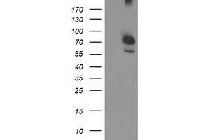 Western Blotting (WB) image for anti-Calpain 9 (CAPN9) antibody (ABIN1497091) (Calpain 9 抗体)
