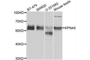 Western blot analysis of extracts of various cell lines, using KPNA6 antibody. (KPNA6 抗体  (AA 277-536))