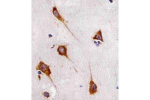(ABIN6243853 and ABIN6577112) staining FA in human brain sections by Immunohistochemistry (IHC-P - paraformaldehyde-fixed, paraffin-embedded sections). (FAM120A 抗体)