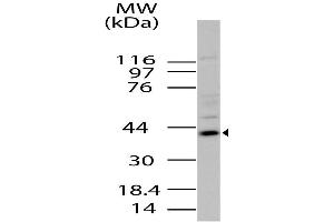 Image no. 1 for anti-Radical S-Adenosyl Methionine Domain Containing 2 (RSAD2) (AA 100-330) antibody (ABIN5027637) (RSAD2 抗体  (AA 100-330))