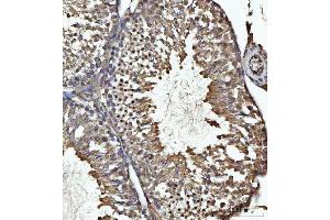 IHC analysis of USP26 using anti-USP26 antibody (ABIN7599543).