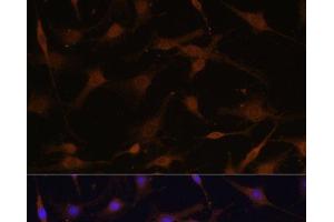 Immunofluorescence analysis of C6 cells using PRKAB2 Polyclonal Antibody at dilution of 1:100 (40x lens). (PRKAB2 抗体)