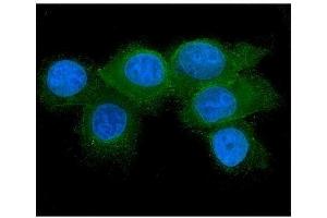 IF analysis of RAB27A using anti-RAB27A antibody (ABIN7602714).