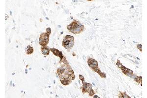 ABIN6268773 at 1/100 staining human breast tissue sections by IHC-P. (KRT14 抗体  (N-Term))