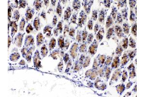 IHC analysis of TFF3 using anti-TFF3 antibody . (TFF3 抗体  (AA 23-81))