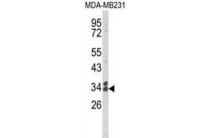 Western Blotting (WB) image for anti-Clathrin, Light Chain A (CLTA) antibody (ABIN3004002) (CLTA 抗体)