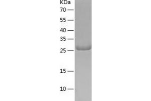 Western Blotting (WB) image for Ubiquitin-Conjugating Enzyme E2Q Family Member 1 (UBE2Q1) (AA 1-253) protein (His tag) (ABIN7287775) (UBE2Q1 Protein (AA 1-253) (His tag))