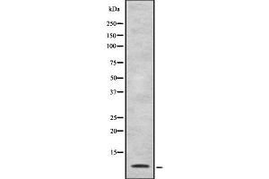 Western blot analysis of Defensin alpha4 using HuvEc whole cell lysates (DEFA4 抗体)