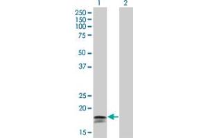 Western Blot analysis of IFNA2 expression in transfected 293T cell line by IFNA2 monoclonal antibody (M33), clone 4H3. (IFNA2 抗体  (AA 24-188))