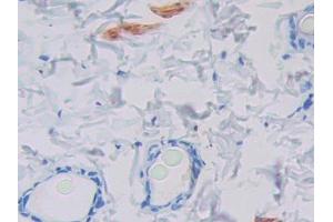 Used in DAB staining on fromalin fixed paraffin- embedded stomach tissue (PIP 抗体  (AA 41-139))