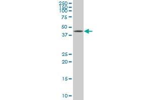 XBP1 monoclonal antibody (M01), clone 3F5. (XBP1 抗体  (AA 123-225))