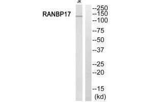 Western blot analysis of extracts from Jurkat cells, using RANBP17 antibody. (RANBP17 抗体  (N-Term))