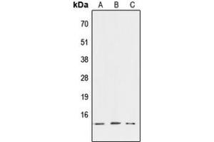 Western blot analysis of ATP6V1G3 expression in HEK293T (A), NIH3T3 (B), PC12 (C) whole cell lysates. (ATP6V1G3i 抗体  (Center))