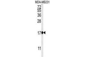 Western Blotting (WB) image for anti-Adaptor Related Protein Complex 1 sigma 1 (AP1S1) antibody (ABIN3002203) (AP1S1 抗体)