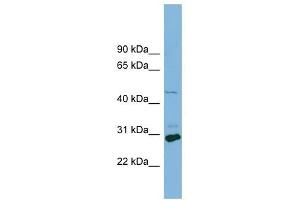 SLC16A1 antibody used at 1 ug/ml to detect target protein. (SLC16A1 抗体)