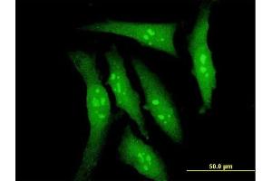 Immunofluorescence of monoclonal antibody to DYRK2 on HeLa cell. (DYRK2 抗体  (AA 1-100))