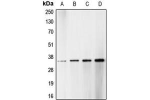 Western blot analysis of CDK1/2/3 (pT14) expression in HT29 hydroxyurea-treated (A), HeLa (B), NIH3T3 (C), A431 (D) whole cell lysates. (CDK1/2/3 (N-Term), (pSer14) 抗体)