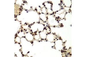 Immunohistochemistry of paraffin-embedded mouse lung using DDX5 antibody. (DDX5 抗体  (AA 1-614))