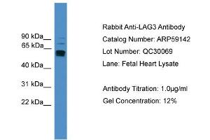 WB Suggested Anti-LAG3  Antibody Titration: 0. (LAG3 抗体  (C-Term))