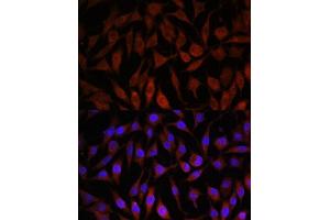 Immunofluorescence analysis of L929 cells using NEDD4L antibody (ABIN6132407, ABIN6144504, ABIN6144505 and ABIN6224109) at dilution of 1:100. (NEDD4-2 抗体  (AA 836-955))