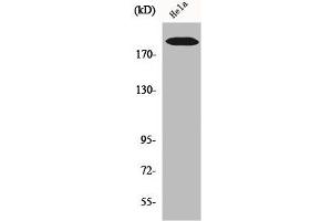 Western Blot analysis of Hela cells using COL5A1 Polyclonal Antibody (COL5A1 抗体  (Internal Region))