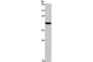 Western Blotting (WB) image for anti-Transcription Factor Dp-1 (TFDP1) antibody (ABIN2825366) (DP1 抗体)