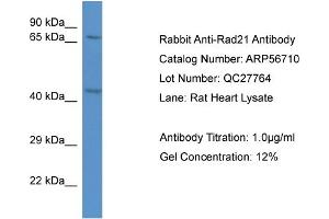 Western Blotting (WB) image for anti-RAD21 Homolog (RAD21) (C-Term) antibody (ABIN2786858) (RAD21 抗体  (C-Term))