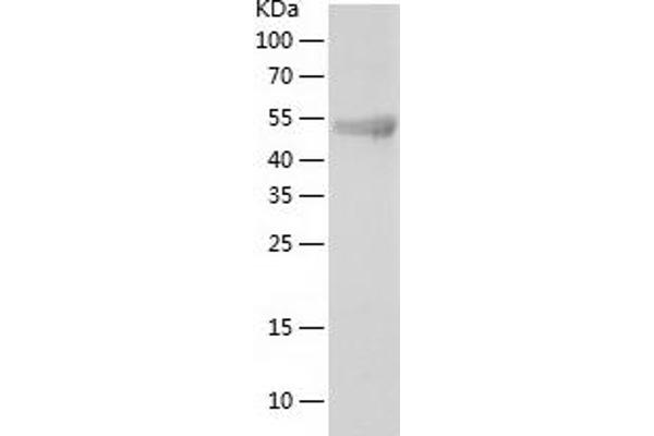 TOR1AIP2 Protein (AA 2-214) (His tag)