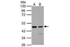 WB Image Sample (30 ug of whole cell lysate) A: JC B: C2C12 10% SDS PAGE antibody diluted at 1:1000 (IDH1 抗体  (Center))