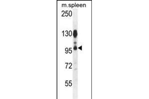 AC Antibody (N-term) 1134a western blot analysis in mouse spleen tissue lysates (35 μg/lane). (ACAP1 抗体  (N-Term))