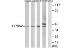 Western blot analysis of extracts from COLO/HuvEc/HeLa/HepG2 cells, using GPR52 Antibody. (GPR52 抗体  (AA 311-360))