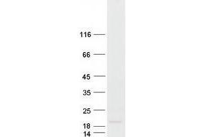 Western Blotting (WB) image for KiSS-1 Metastasis-Suppressor (KISS1) protein (Myc-DYKDDDDK Tag) (ABIN2724263)