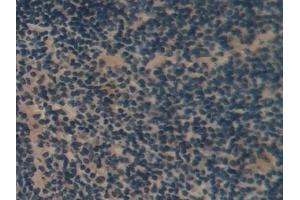 Immunohistochemistry (IHC) image for anti-Advanced Glycosylation End Product-Specific Receptor (AGER) (AA 1-237) antibody (ABIN7441463)