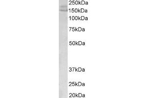 ABIN5539465(0. (AKAP12 抗体  (C-Term))