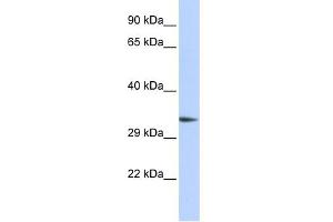 WB Suggested Anti-PACRG Antibody Titration: 0. (PACRG 抗体  (Middle Region))