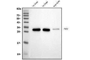 Western blot analysis of Tigit using anti-Tigit antibody (ABIN7601117).