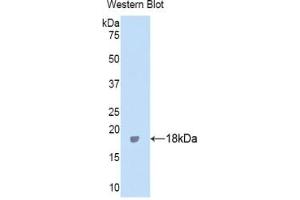 Detection of Recombinant ITIH4, Human using Polyclonal Antibody to Inter Alpha-Globulin Inhibitor H4 (ITIH4) (ITIH4 抗体  (AA 273-424))