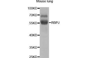 Western Blotting (WB) image for anti-Recombination Signal Binding Protein For Immunoglobulin kappa J Region (RBPJ) antibody (ABIN1876876) (RBPJ 抗体)