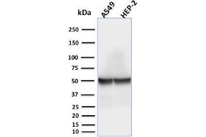 Western Blot Analysis of A549 and HEP-2 cell lysates using Cytokeratin 18 Mouse Monoclonal Antibody (rKRT18/1190). (Recombinant Cytokeratin 18 抗体)