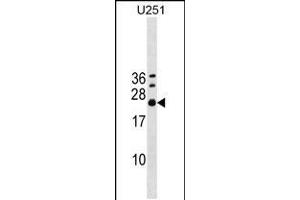 Western blot analysis in U251 cell line lysates (35ug/lane). (EXOSC4 抗体  (AA 69-96))